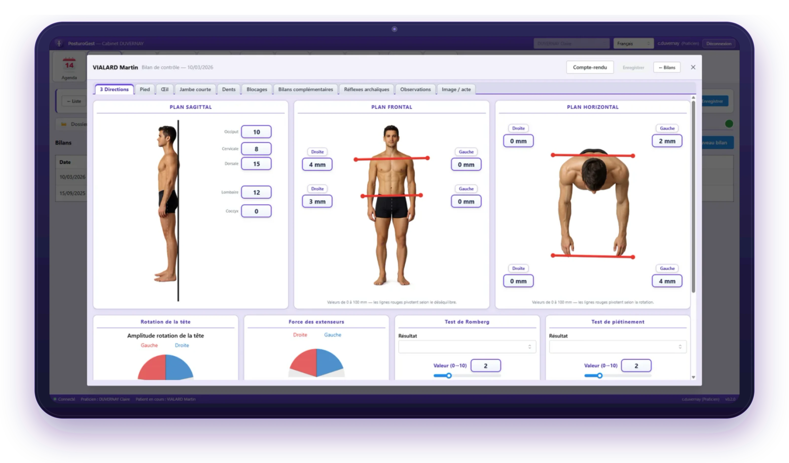 Bilan postural de PosturoGest PRO réalisé sur une tablette
